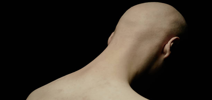 Rear view of sorrowful man with bald head and face hidden